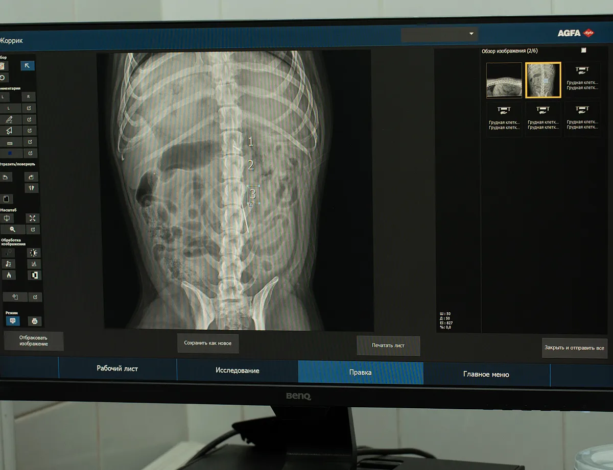 Визуальная диагностика (Рентген)